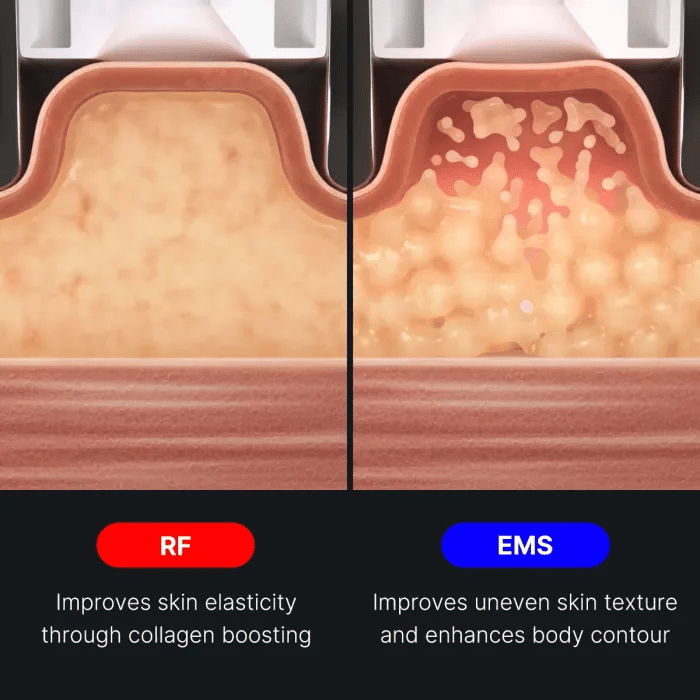 AGE-R Contour Body Shot - Image 5
